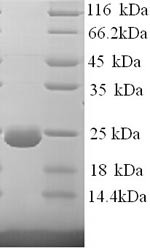 Dystonin (DST), partial, human, recombinant