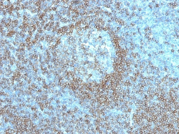Anti-CD45RA (Leukocyte marker), clone K4B5
