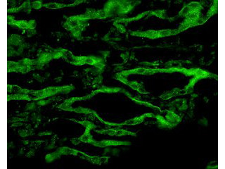Anti-Aquaporin 4