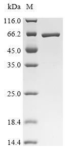 Interferon-induced protein with tetratricopeptide repeats 1(IFIT1), human, recombinant