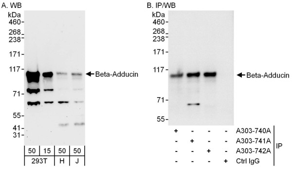 Anti-Beta-Adducin
