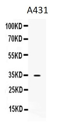 Anti-NAT1