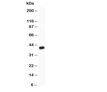 Anti-MRP4