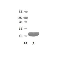 FRMPD2_1 PDZ Domain