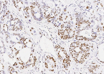 Anti-MSH6/GTBP Monoclonal Recombinant Antibody