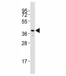 Anti-Rhodopsin / Zebrafish