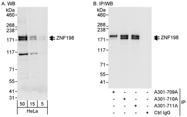 Anti-ZNF198