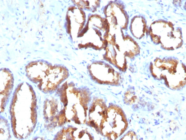 Anti-Prostate Specific Acid Phosphatase (PSAP), clone PASE/4LJ