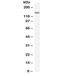 Anti-KDR / Kinase Insert Domain Receptor