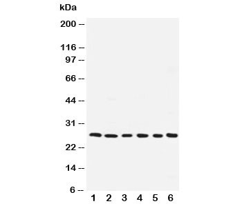 Anti-ARC / Apoptosis Repressor with CARD / NOL3