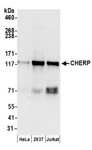 Anti-CHERP