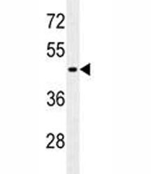 Anti-GFAP (Astrocyte Marker), clone 183CT3.1.5