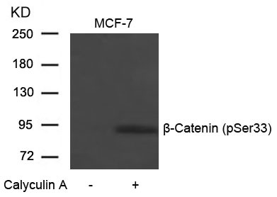 Anti-phospho-beta Catenin (Ser33)