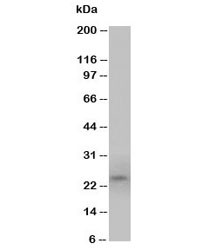 Anti-PrP Prion protein