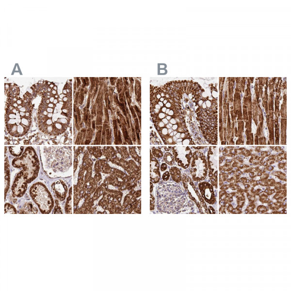 Anti-ATP5A1
