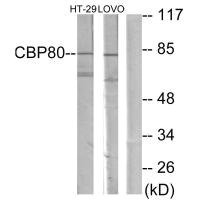 Anti-NCBP1