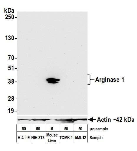 Anti-Arginase 1 Recombinant Monoclonal