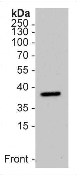 Anti-Survival Motor Neuron Protein (human), clone 7B10