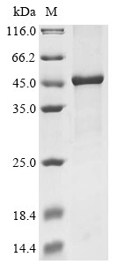 Ubiquitin carboxyl-terminal hydrolase CYLD (Cyld), partial, mouse, recombinant