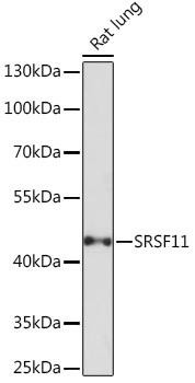 Anti-SRSF11