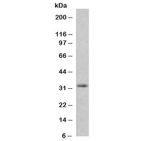 Anti-MTAP, clone SMTP-1R