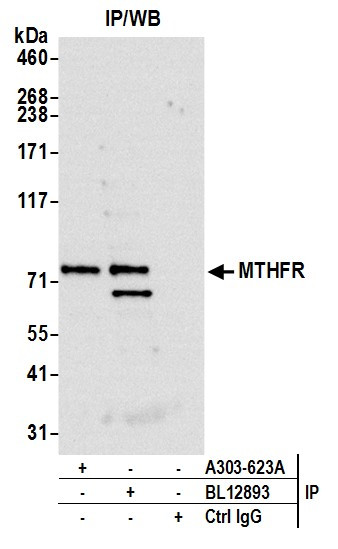 Anti-MTHFR