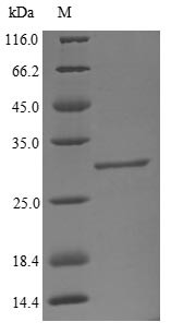 Beta-1,4-galactosyltransferase 1 (B4GALT1), partial, bovine, recombinant