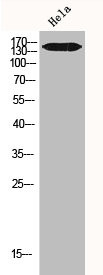 Anti-IGF1R/INSR
