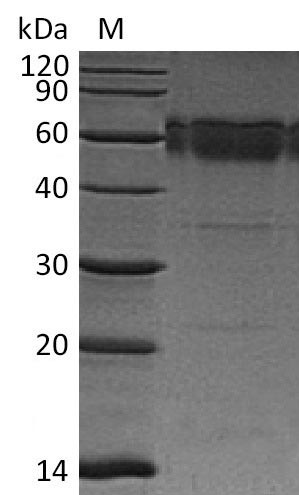 Tumor necrosis factor receptor superfamily member 10B (Tnfrsf10b), partial (Active), mouse, recombin