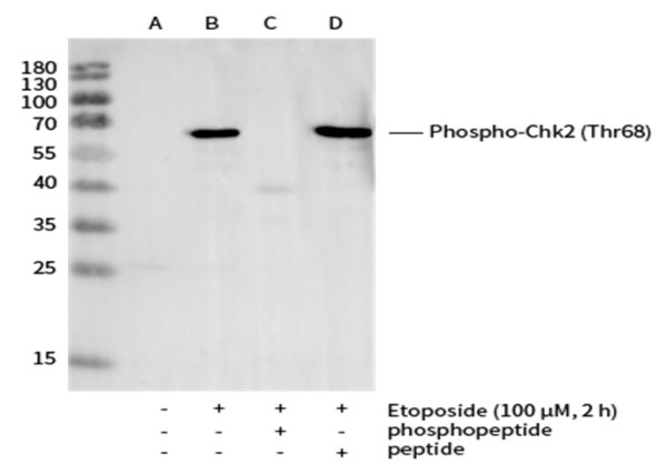 Anti-Phospho-Chk2 (Thr68) Monoclonal Recombinant Antibody