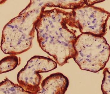 Anti-CD71 / Transferrin Receptor