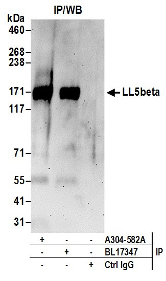 Anti-LL5beta