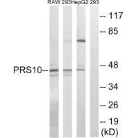 Anti-PSMC6