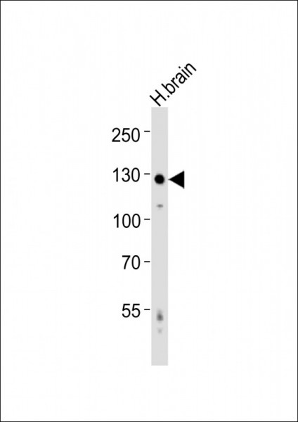 Anti-Amphiphysin / AMPH