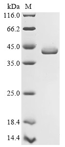 Virulence sensor histidine kinase PhoQ (phoQ), partial, Salmonella typhimurium, recombinant