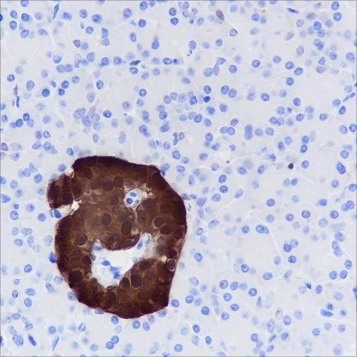 Anti-Recombinant SCGN, clone A357