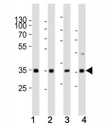 Anti-Cyclin D3 (CCND3)