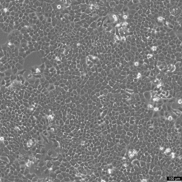 Caov-3 Cells
