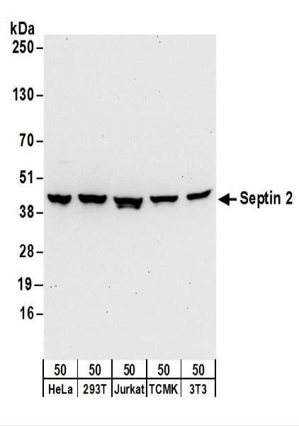 Anti-Septin 2