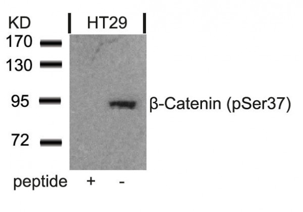 Anti-phospho-beta Catenin (Ser37)
