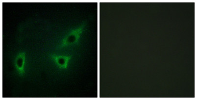 Anti-ATP7B