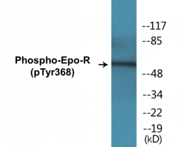 Epo-R (Phospho-Tyr368) Colorimetric Cell-Based ELISA Kit