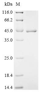 F-box/LRR-repeat protein 2 (FBXL2), recombinant human