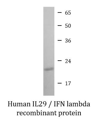 Human IL29 / IFN lambda recombinant protein (Active)