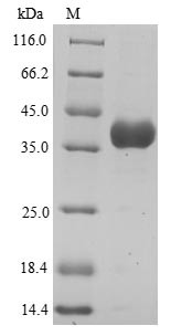 Annexin A3 (ANXA3), partial, human, recombinant