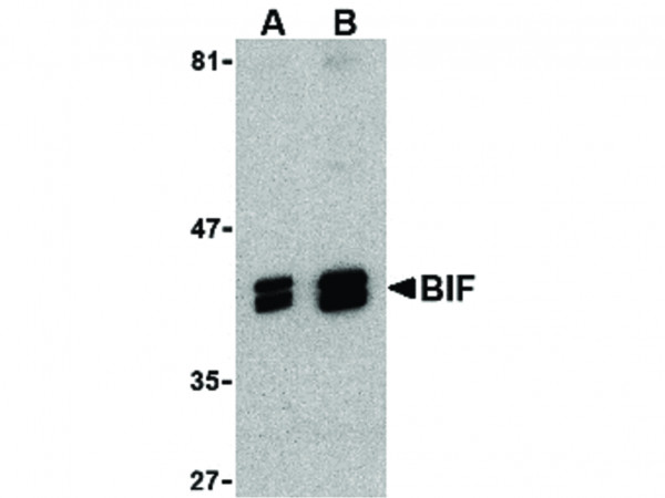 Anti-Bif