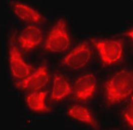 Anti-MBTPS1