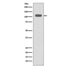 Anti-Integrin beta 3 / ITGB3 / CD61, clone BFE-9