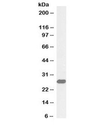 Anti-ETFB Biotin Conjugate