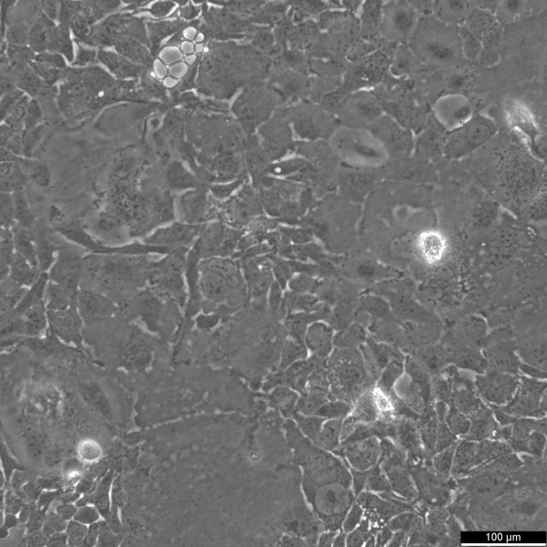 SW 1990 Cells